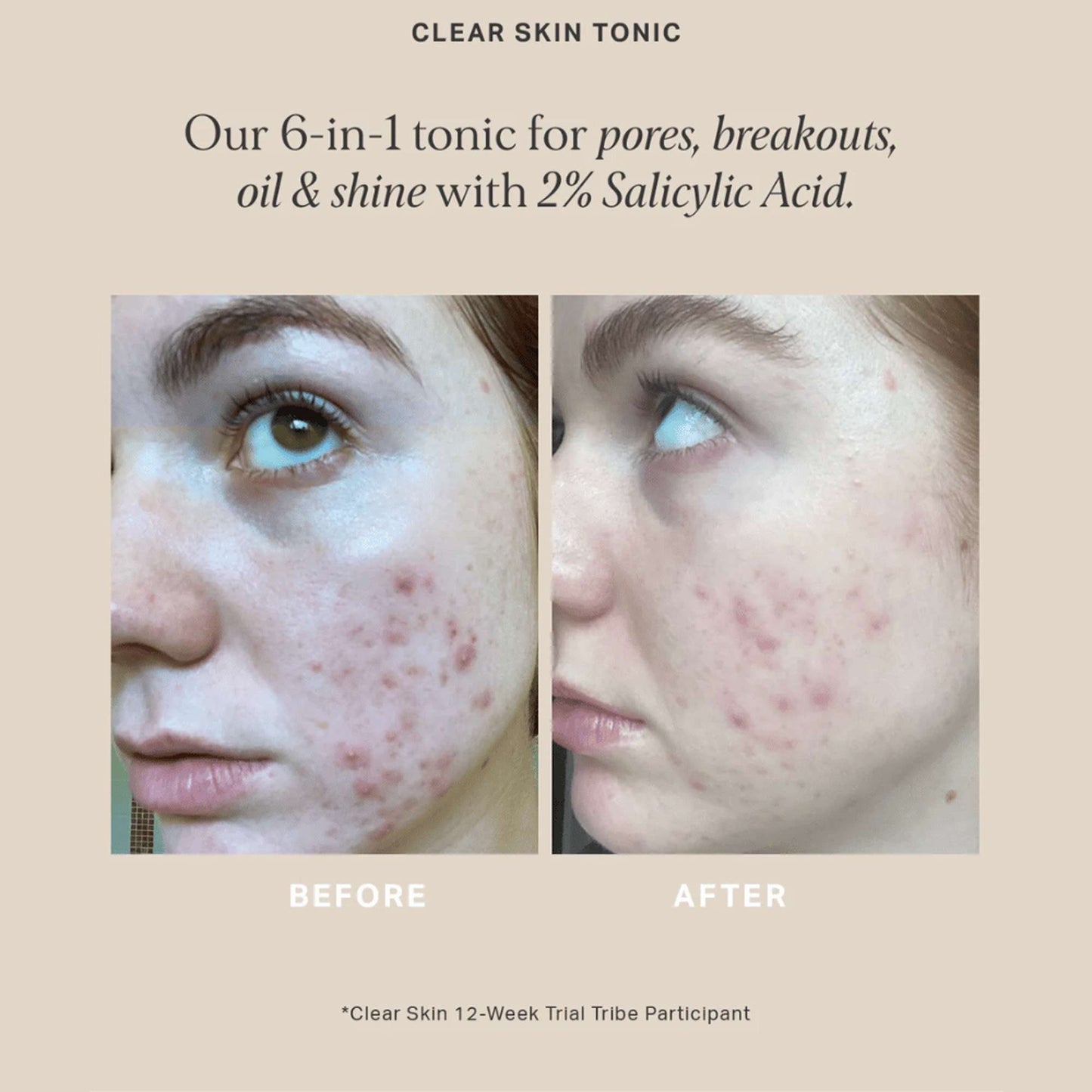 Alpha H Moisturiser Clear Skin Tonic 100ml - Additional 1