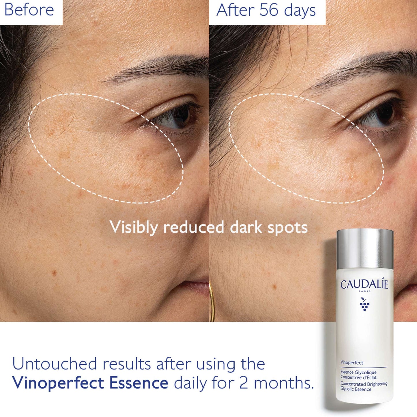 Caudalie Vinoperfect Concentrated Brightening Glycolic Essence 100ml - Additional 3