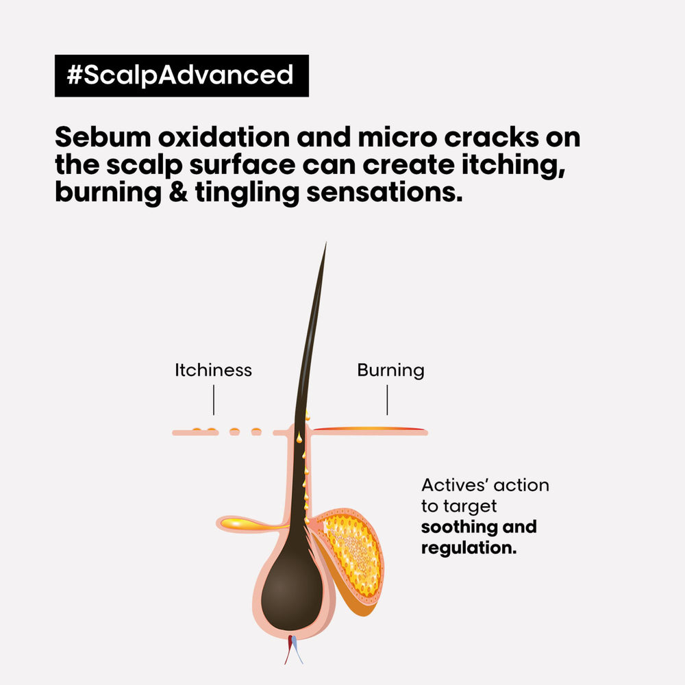 L'Oréal Professionnel SERIE EXPERT Scalp Advanced Anti-Discomfort Dermo-Regulator Shampoo 300ml - Additional 2