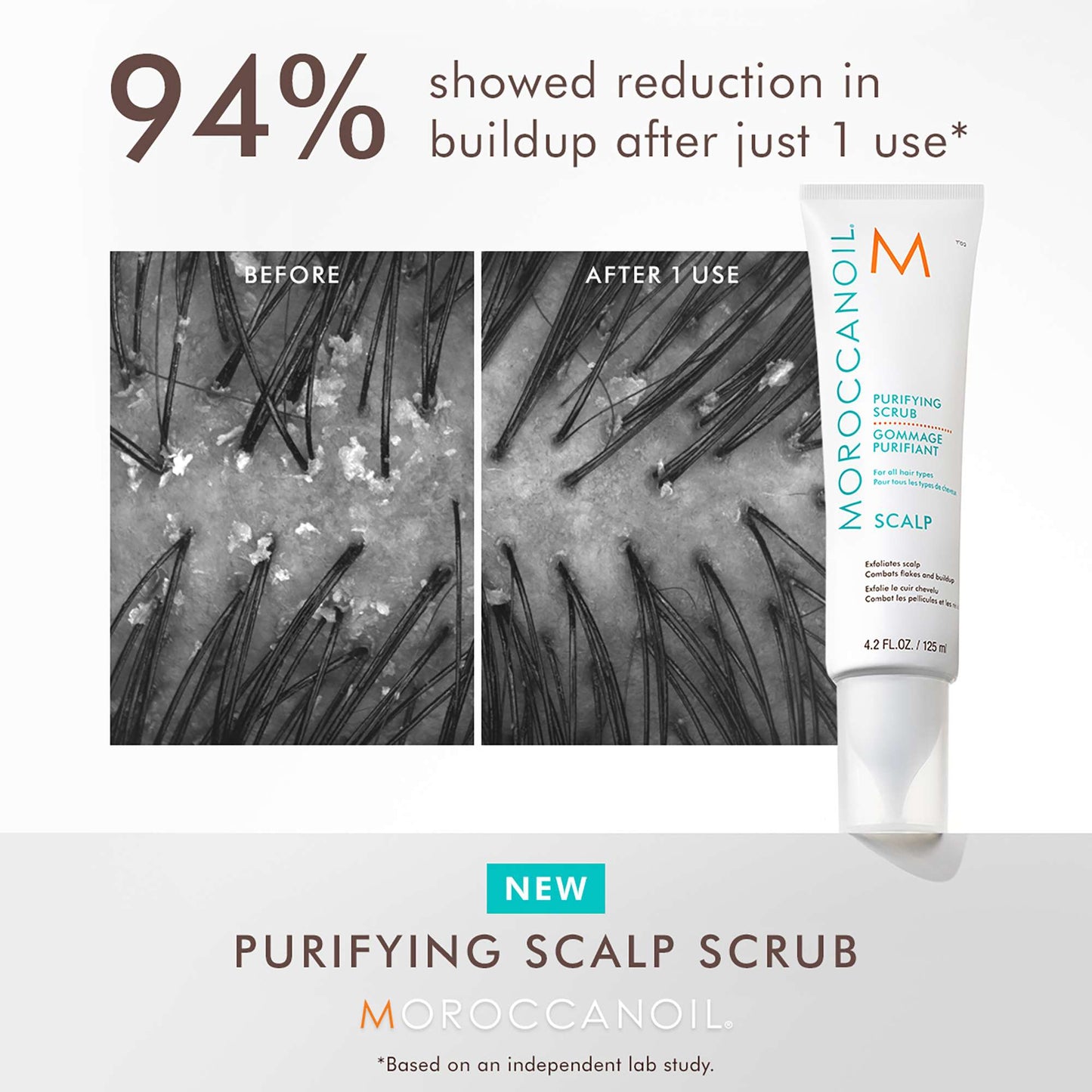 Moroccanoil Treatments & Masks Scalp Purifying Scrub 125ml - Additional 3