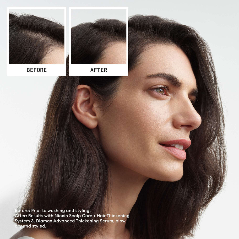 Nioxin Pro Clinical Gifts & Sets System 3 Kit for Coloured Hair with Light Thinning - Additional 5