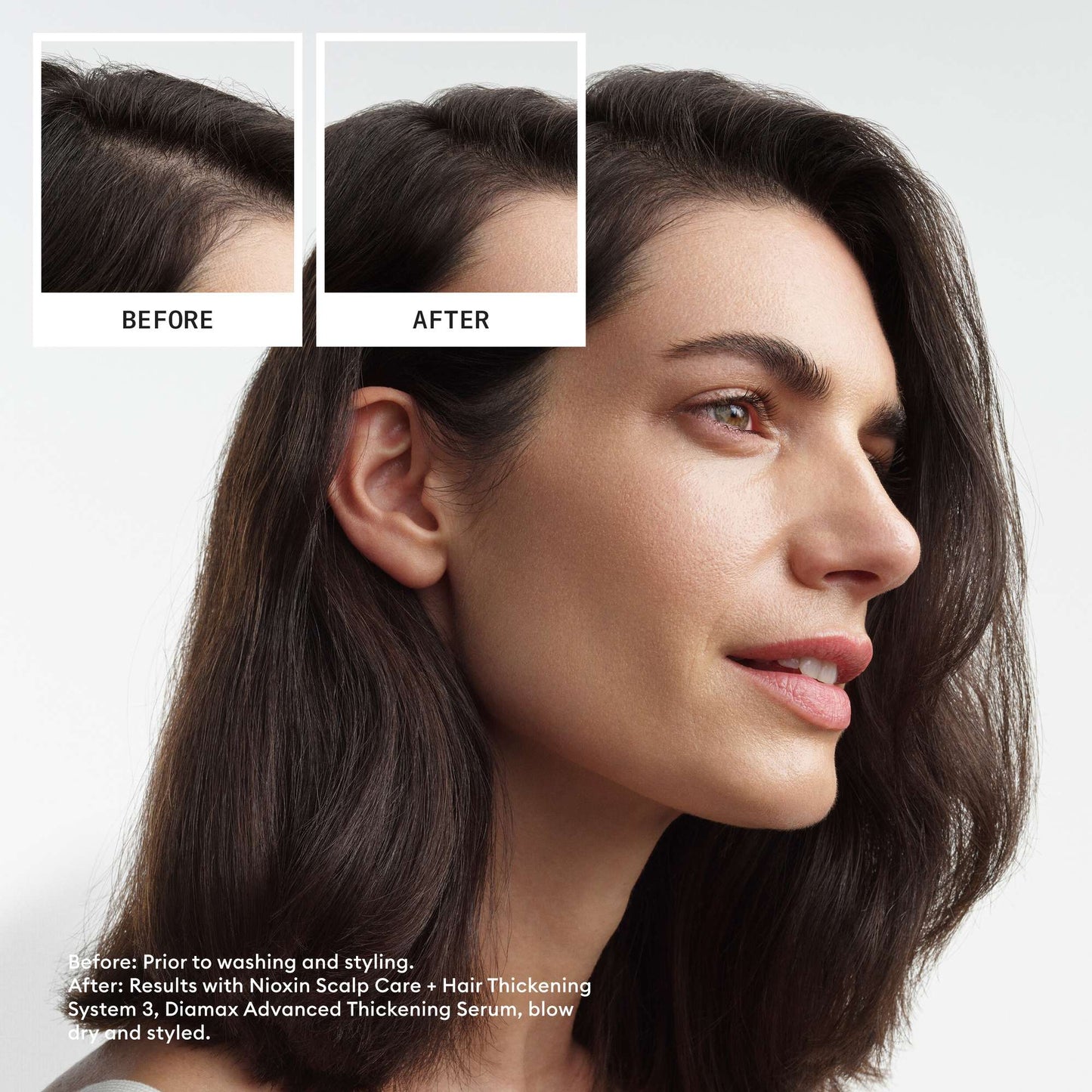 Nioxin Pro Clinical Gifts & Sets System 3 Kit for Coloured Hair with Light Thinning - Additional 5