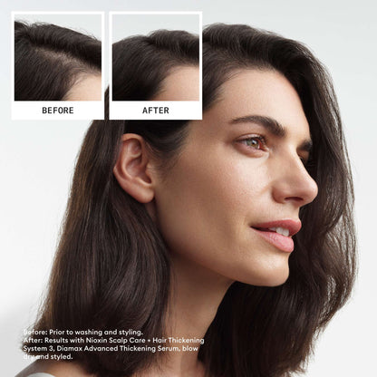Nioxin Pro Clinical Gifts & Sets System 3 Kit for Coloured Hair with Light Thinning - Additional 5