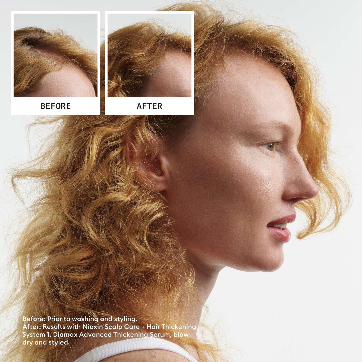 Nioxin Pro Clinical Gifts & Sets System 1 Trial Kit for Natural Hair with Light Thinning - Additional 5