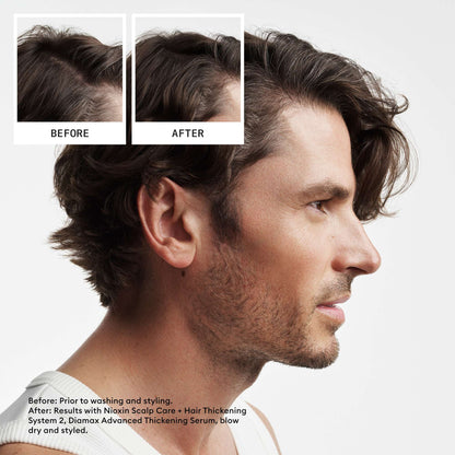 Nioxin Pro Clinical Gifts & Sets System 2 Trial Kit for Natural Hair with Progressed Thinning - Additional 5