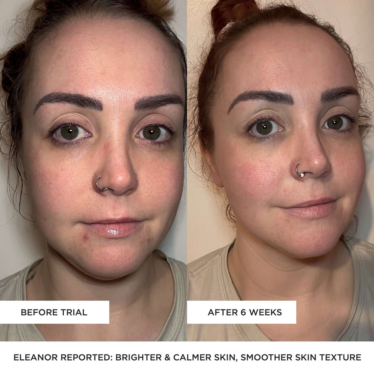 BeautyPro Tools & Accessories Photon Wand - Additional 6