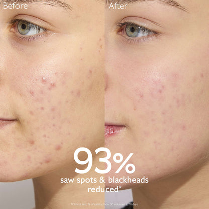 Caudalie Vinopure Oil-Control Moisturiser for Acne Prone Skin 60ml (Launch 25.08.2025) - Additional 2