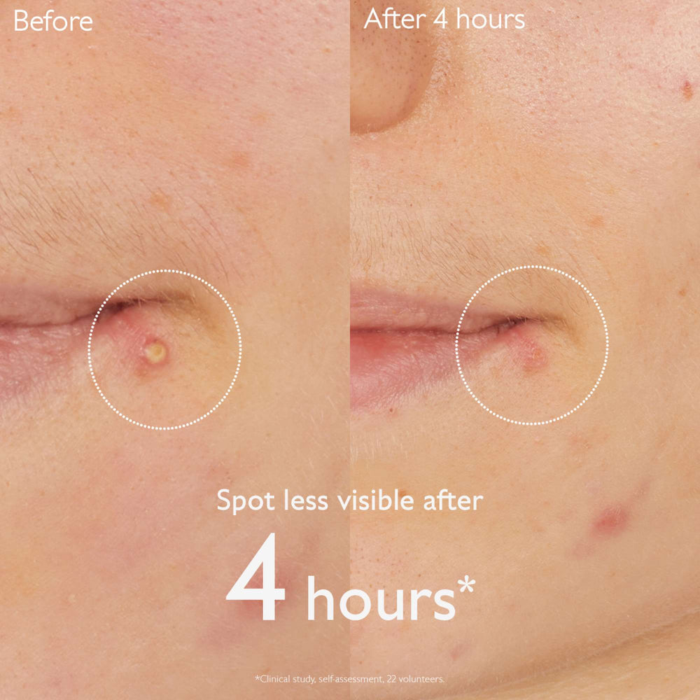 Caudalie Vinopure Salicylic Spot Solution 15ml (Launch 25.08.2025) - Additional 2
