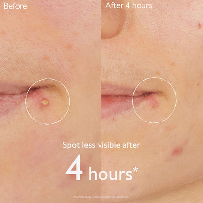 Caudalie Vinopure Salicylic Spot Solution 15ml (Launch 25.08.2025) - Additional 2
