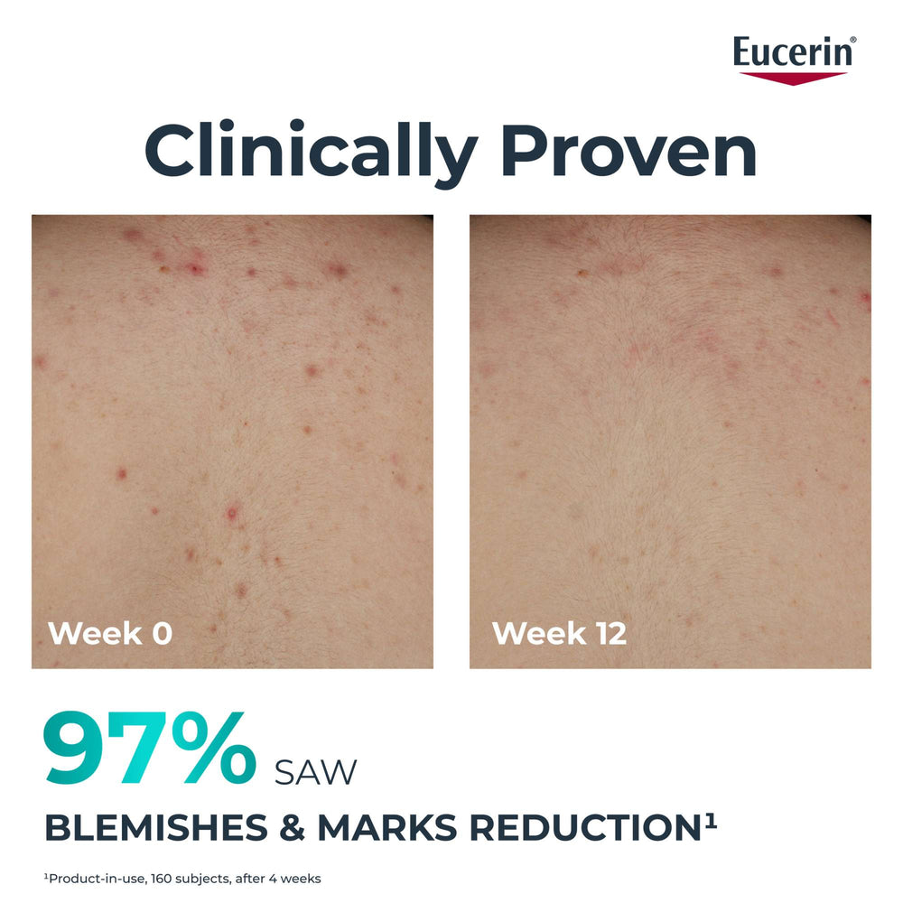 Eucerin DermoPure Clinical Correcting Body Cream 200ml - Additional 5