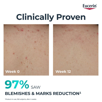 Eucerin DermoPure Clinical Correcting Body Cream 200ml - Additional 5