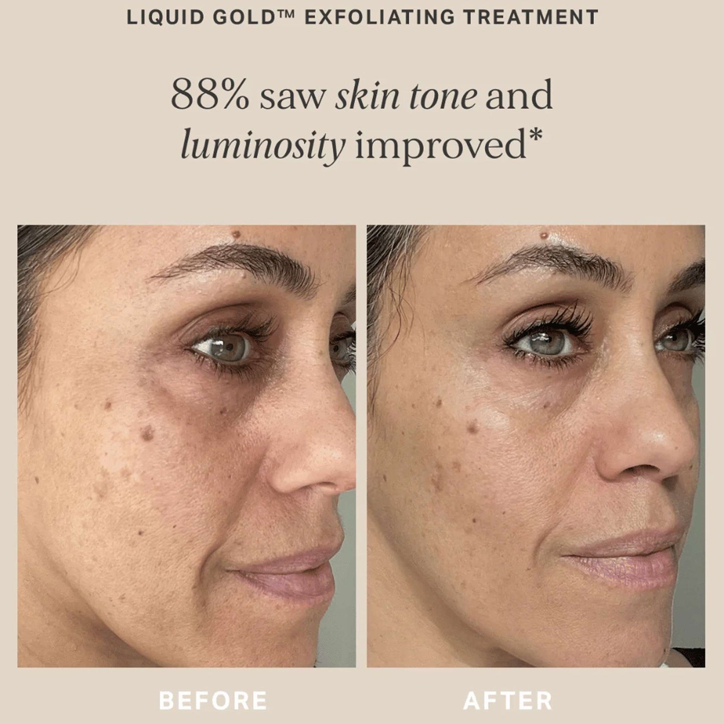Alpha H Exfoliants Liquid Gold Exfoliating Treatment with 5% Glycolic Acid 100ml - Additional 7