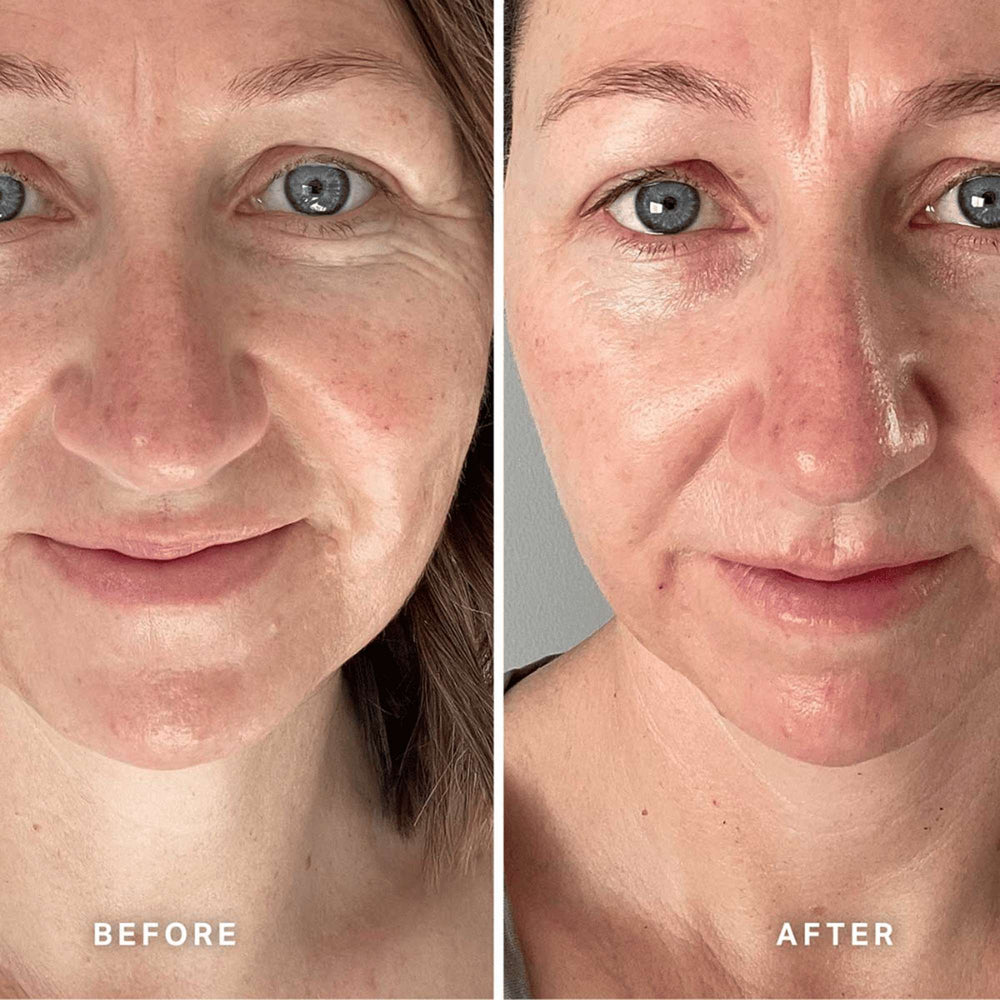 Alpha H Serums Vitamin E with 1% Ceramide Complex 25ml - Additional 4
