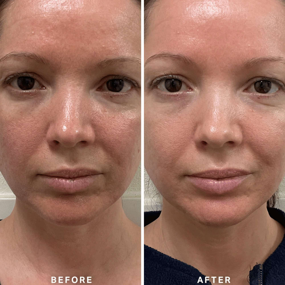 Alpha H Serums Vitamin B with 0.5% Niacinamide 25ml - Additional 4