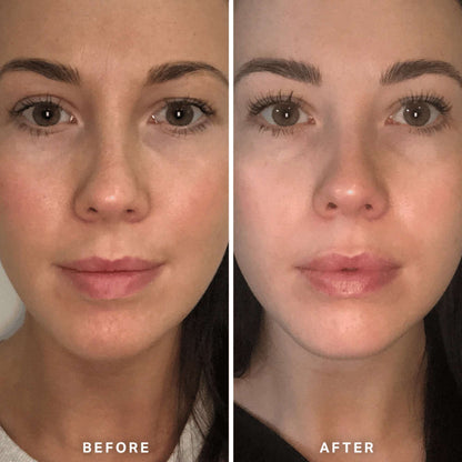 Alpha H Serums Vitamin B with 0.5% Niacinamide 25ml - Additional 5