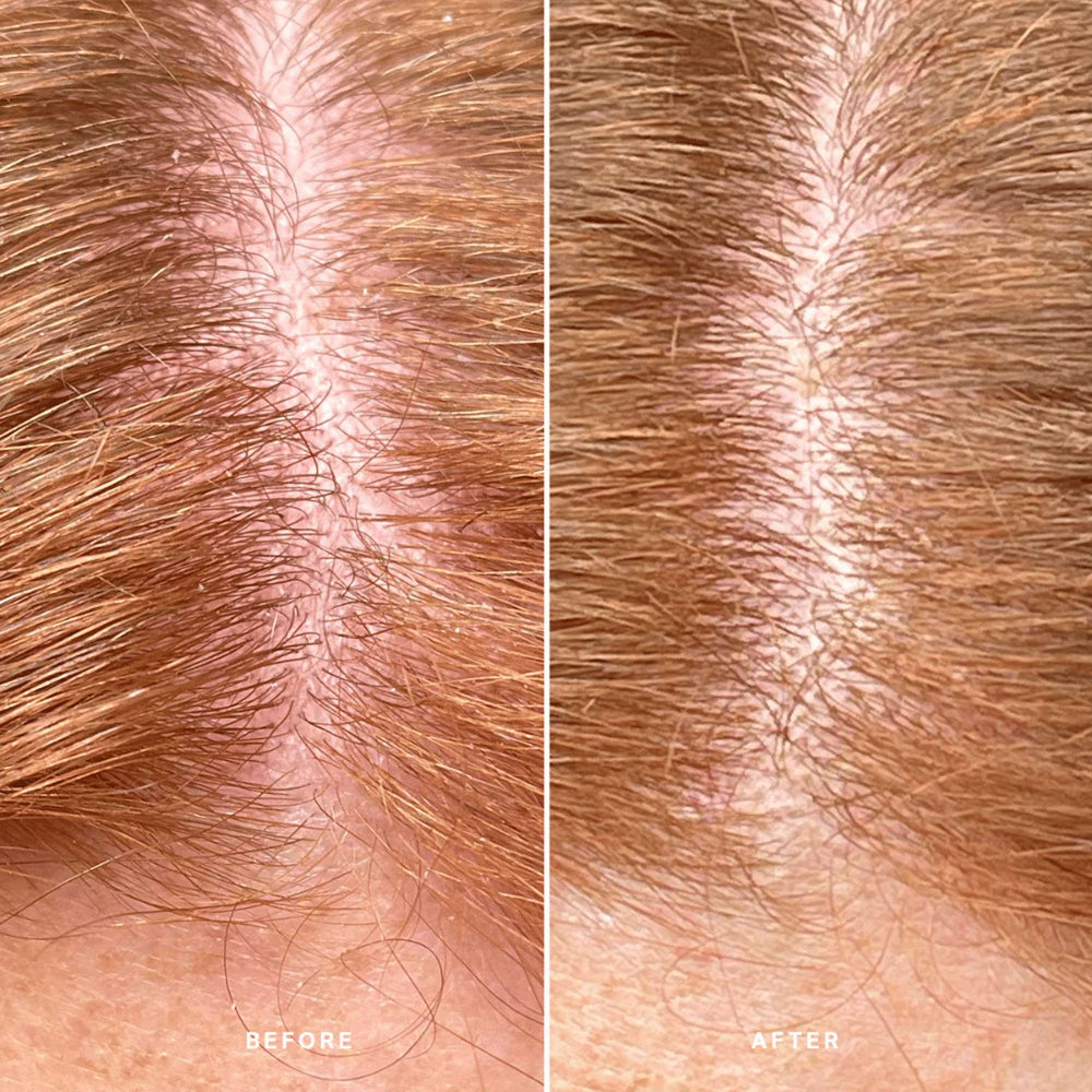Alpha H Exfoliants Healthy Exfolitating Scalp Treatment 100ml - Additional 5