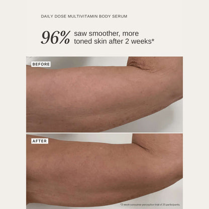 Alpha H Serums Daily Dose Multivitamin Body Serum with Niacinamide, Vitamin C + Hyaluronic Acid 150ml - Additional 2