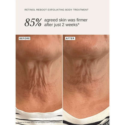 Alpha H Exfoliants Retinol Reboot Exfoliating Body Treatment 120ml - Additional 1