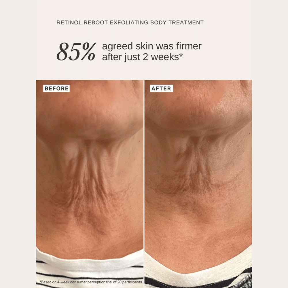 Alpha H Exfoliants Retinol Reboot Exfoliating Body Treatment 120ml - Additional 5