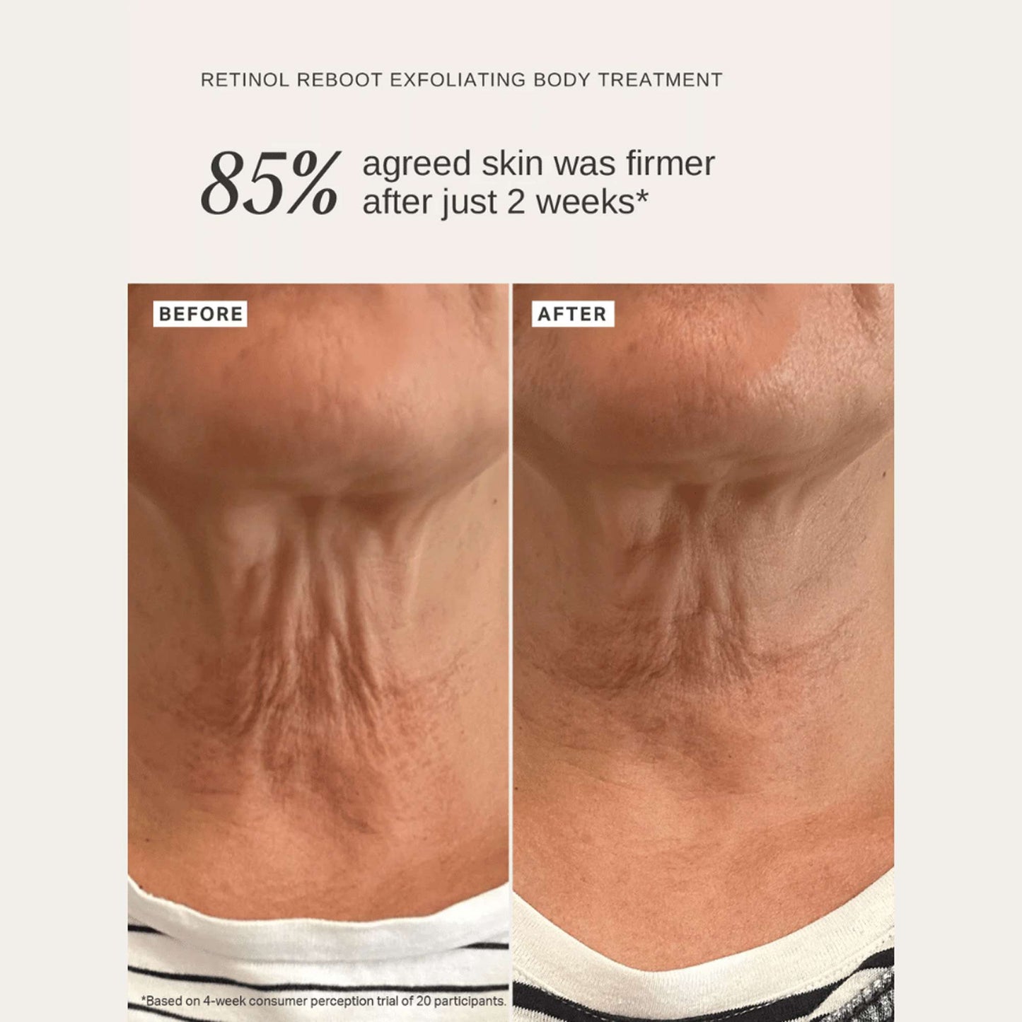 Alpha H Exfoliants Retinol Reboot Exfoliating Body Treatment 120ml - Additional 5