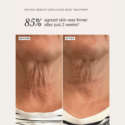 Alpha H Exfoliants Retinol Reboot Exfoliating Body Treatment 120ml - Additional 5