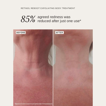 Alpha H Exfoliants Retinol Reboot Exfoliating Body Treatment 120ml - Additional 6