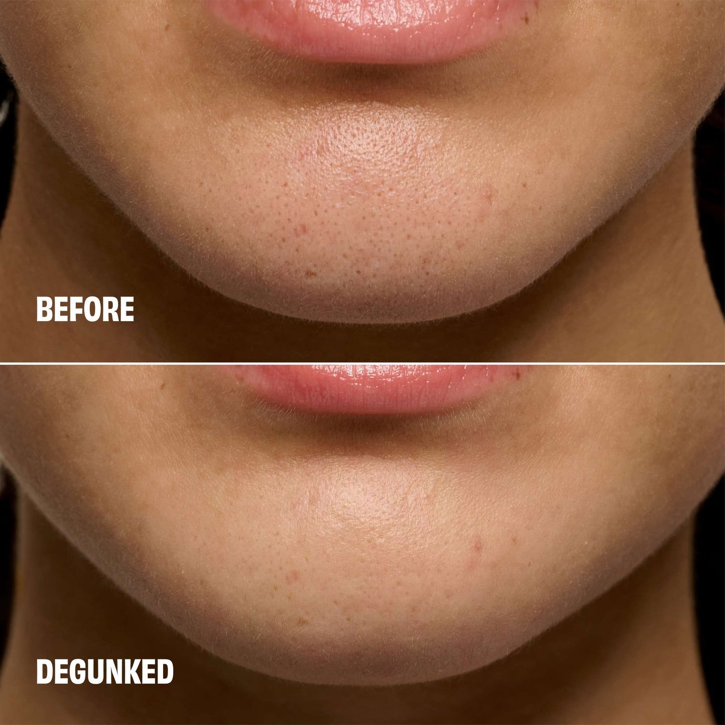 benefit The POREfessional Degunker Blackhead & Pore Cleansing Tool - Additional 4